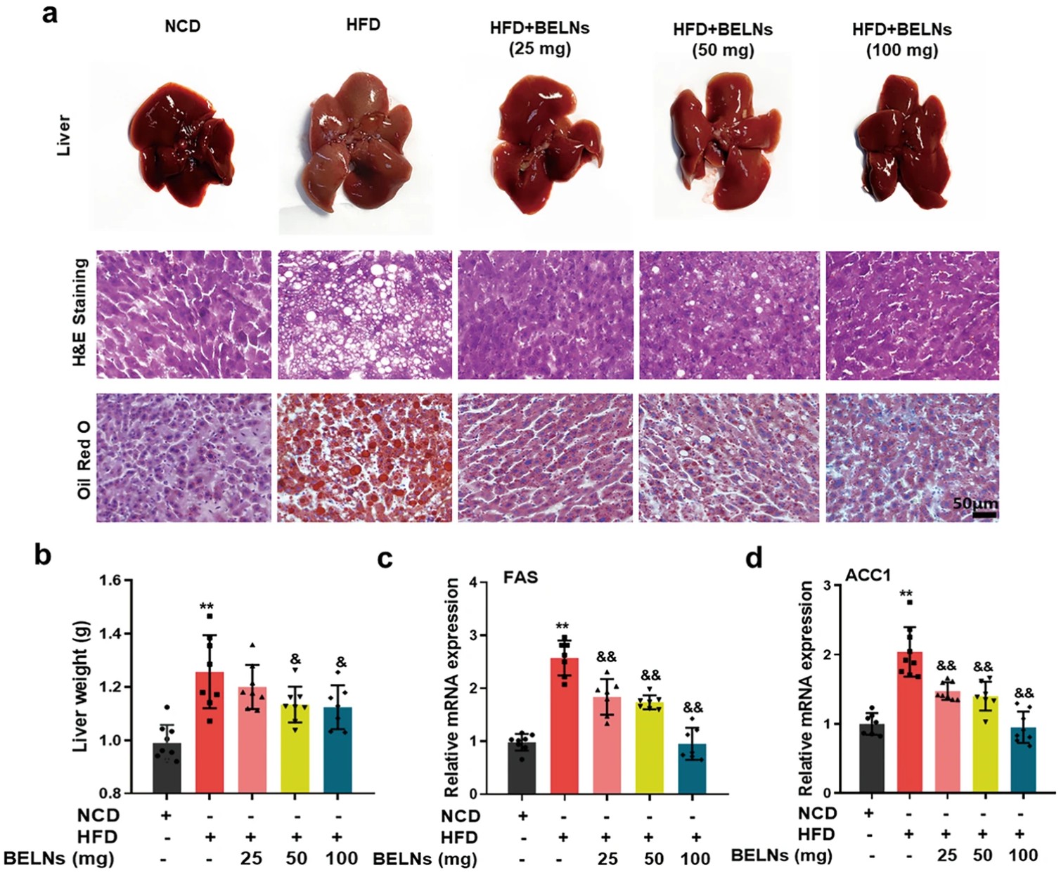 Blueberry-derived exosomes-like nanoparticles reduce liver vacuolation, lipid droplets, and FAS/ACC1 gene expression in HFD-fed mice.